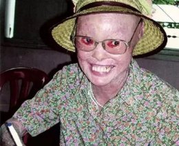 杀死穿山甲夫妻, 生出一个长着穿山甲